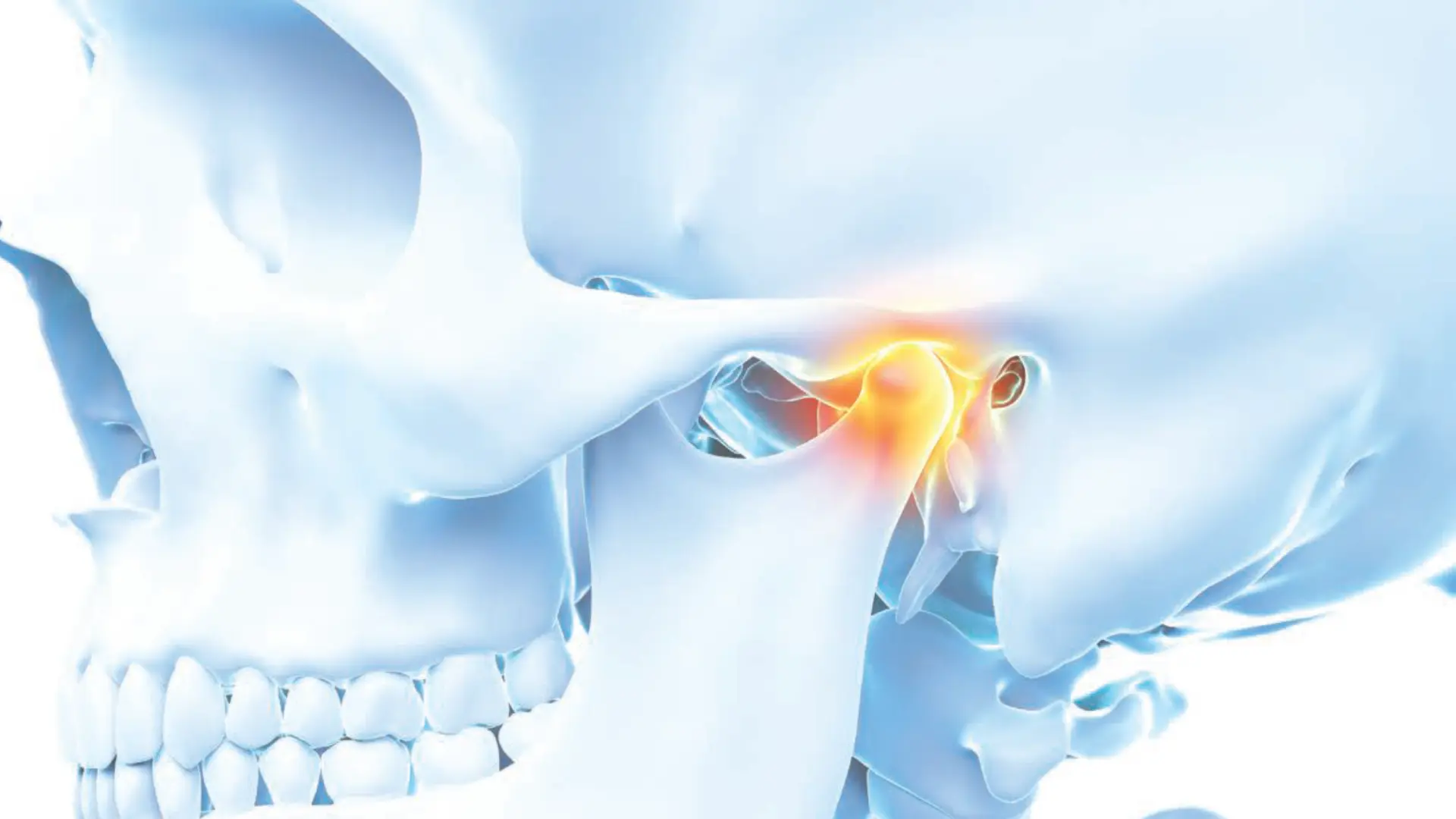 Stylized image of a human jaw with a bright spot to indicate jaw pain.